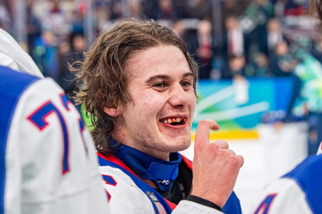 Jack Hughes scores golden goal with broken smile: ‘I looked on the ice and saw my teeth’ GettyImages 2262489773 scaled.jpg